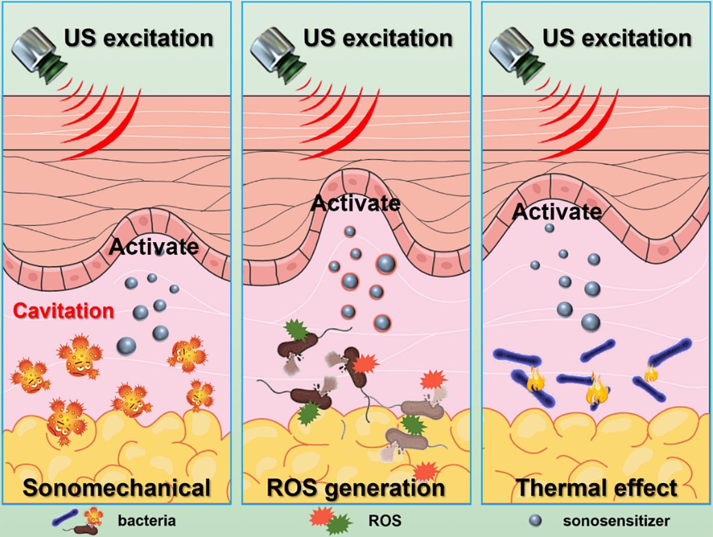 セット image-65121.jpg